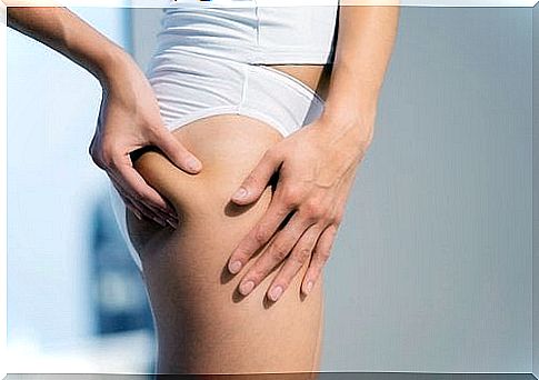 Cellulite after pregnancy