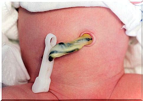 cut the umbilical cord after birth