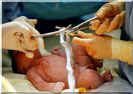 cut the umbilical cord after birth